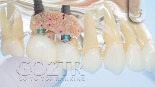 تخصص دندانپزشکی در فیلیپین و شرایط اخذ پذیرش تخصص دندانپزشکی در فیلیپین